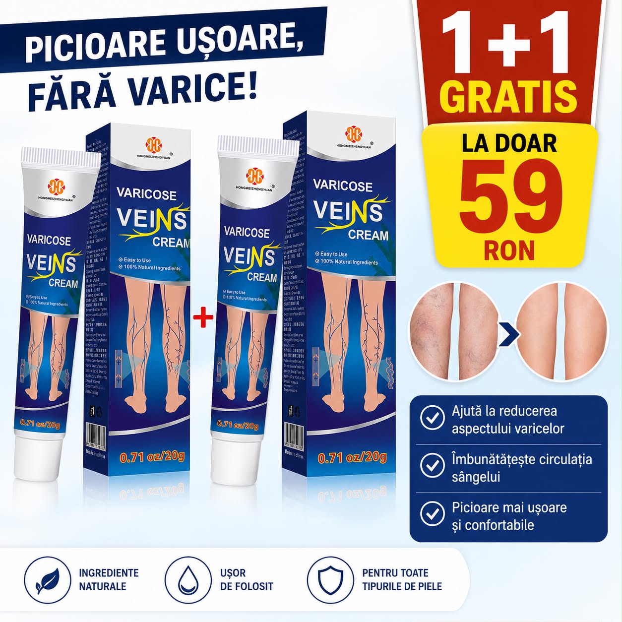 Cremă pentru Picioare Varicose