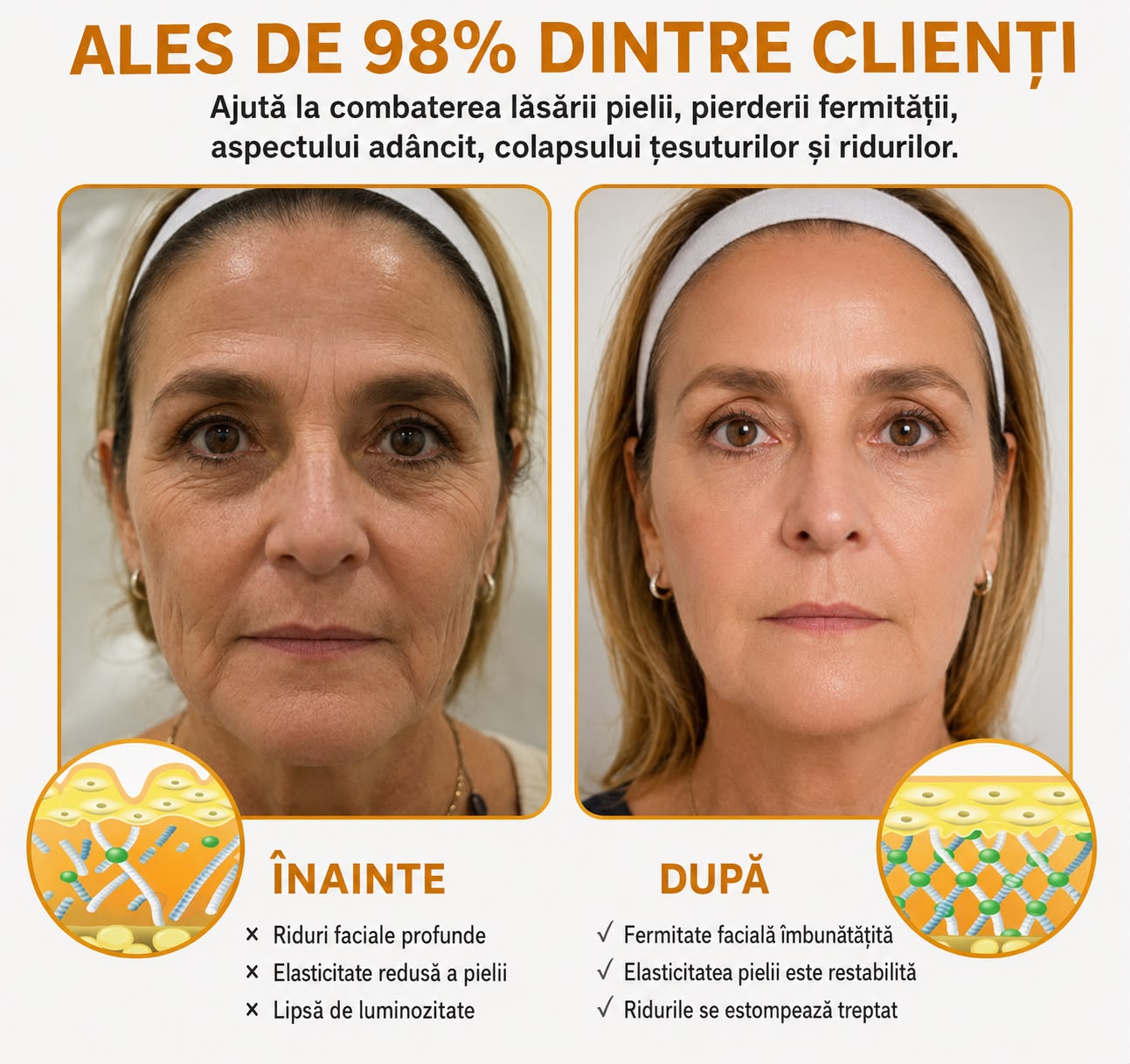 Crema antirid cu venin de albine
